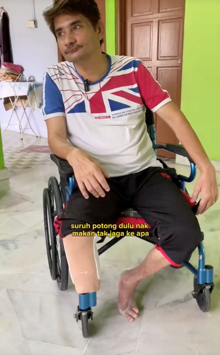 lelaki dedah kakinya kena potong akibat suka minum teh tarik masa usia muda