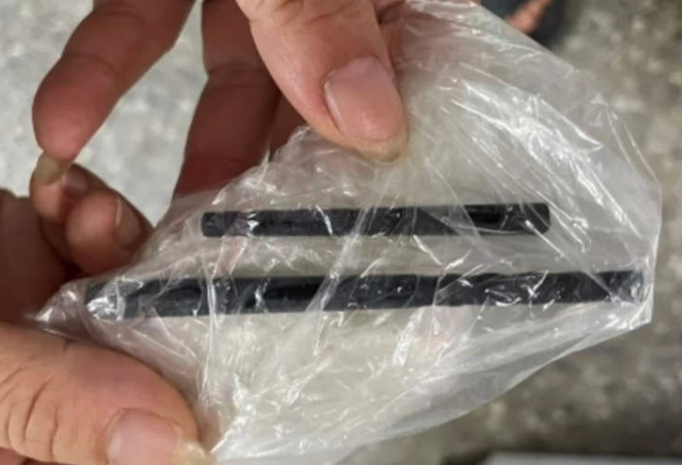 lebih 5 bulan asyik sakit kepala rupanya ada chopstik dalam tengkorak