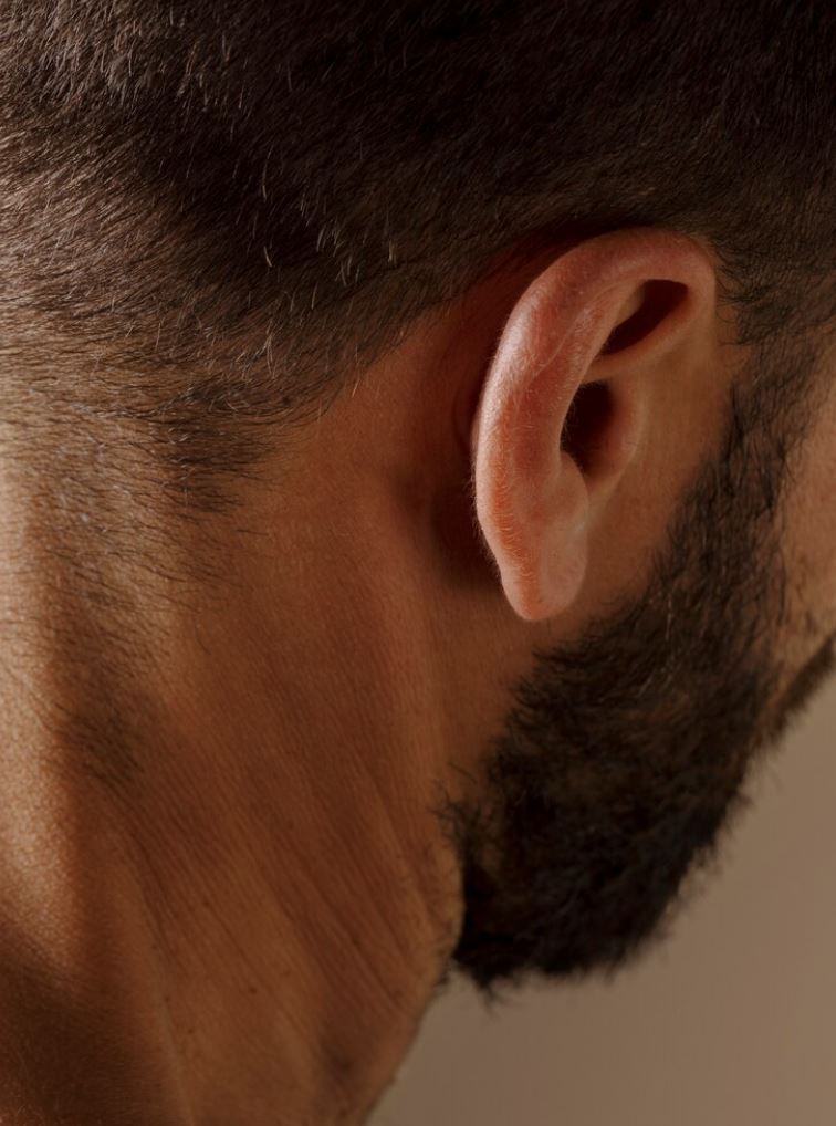 si isteri mengamuk, gigit telinga kanan suami sampai putus