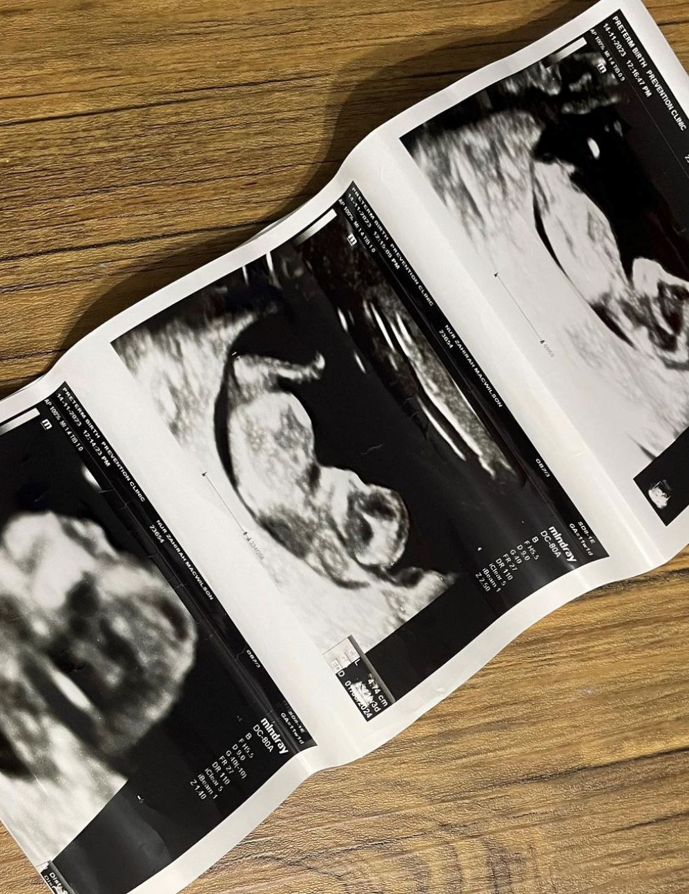 zahirah macwilson kini hamil anak kedua, “tak sabar untuk 2024..”