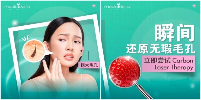 MedicDeno Carbon Laser Therapy海报1