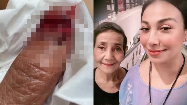 jari ibu ning baizura berdarah, tak keruan jaga sendirian di hospital