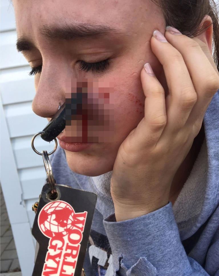 gagal tangkap dengan baik, kunci kereta melekat pada wajah lepas minta rakan baling