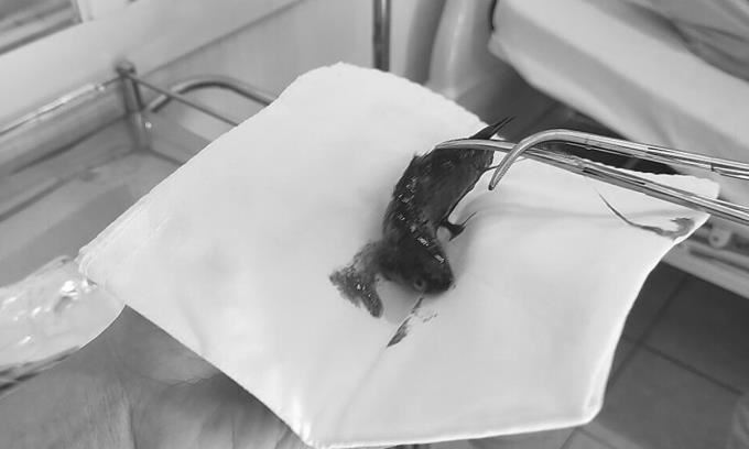 trauma makan ikan, lelaki ini dedah pengalaman ngeri