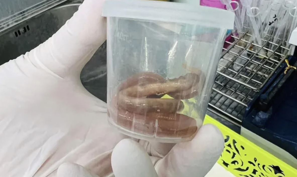 wanita sarat hamil terkejut lepas muntah keluar cacing 15 sentimeter