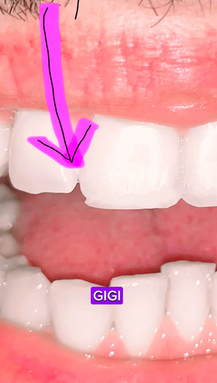 mat saleh ini patah gigi lepas cuba kupas kelapa guna teknik gigit