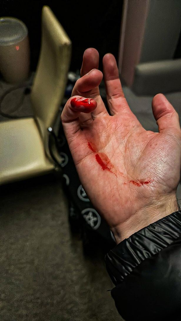 seram! jari berdarah, lelaki diserang makhluk halus semasa buat facebook live