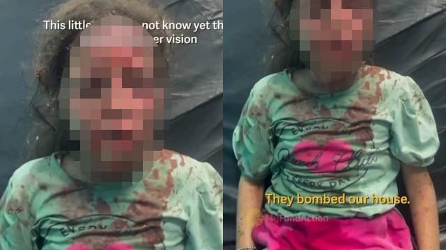 rumah musnah dibom, kanak-kanak tak sedar hilang penglihatan