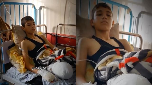 kanak-kanak kehilangan sebelah kaki akibat serangan rejim zionis