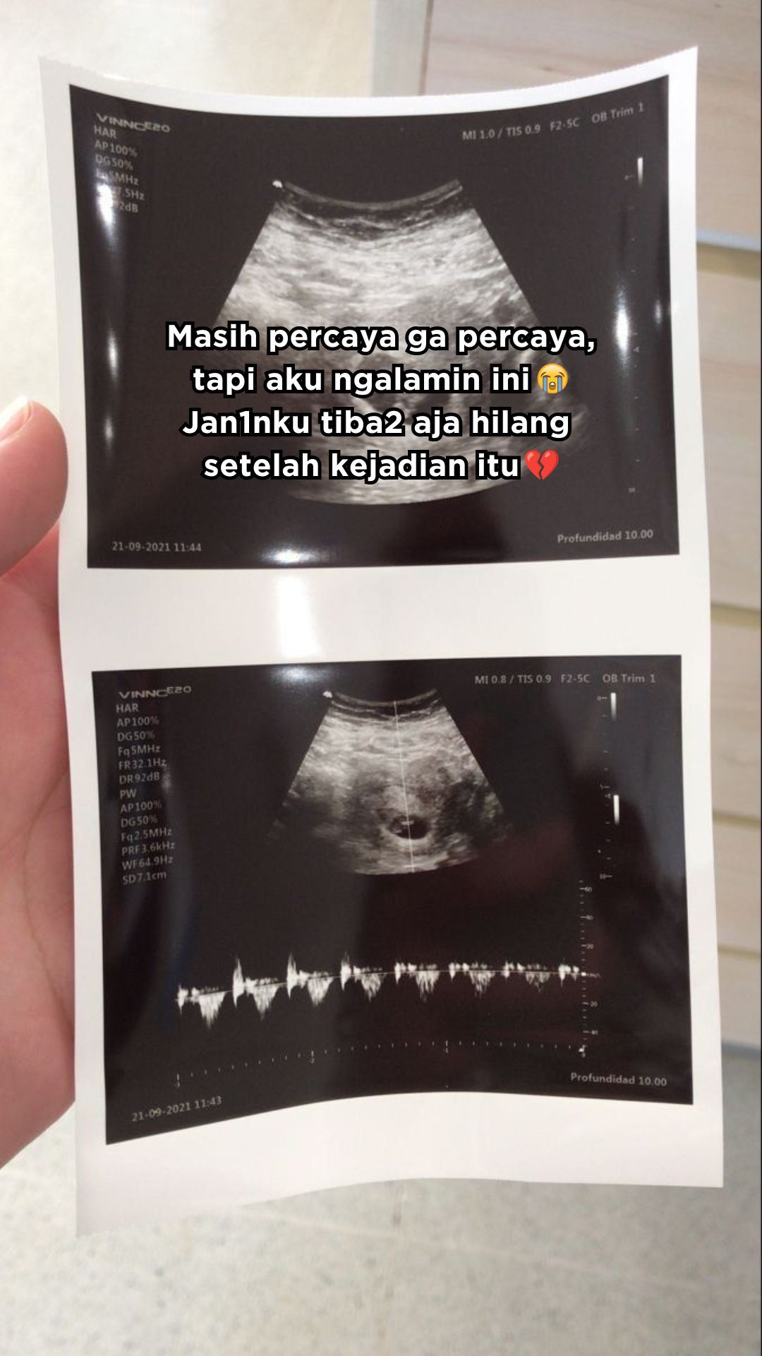 aneh, bayi dalam kandungan hilang lepas tumpangkan nenek tidak dikenali