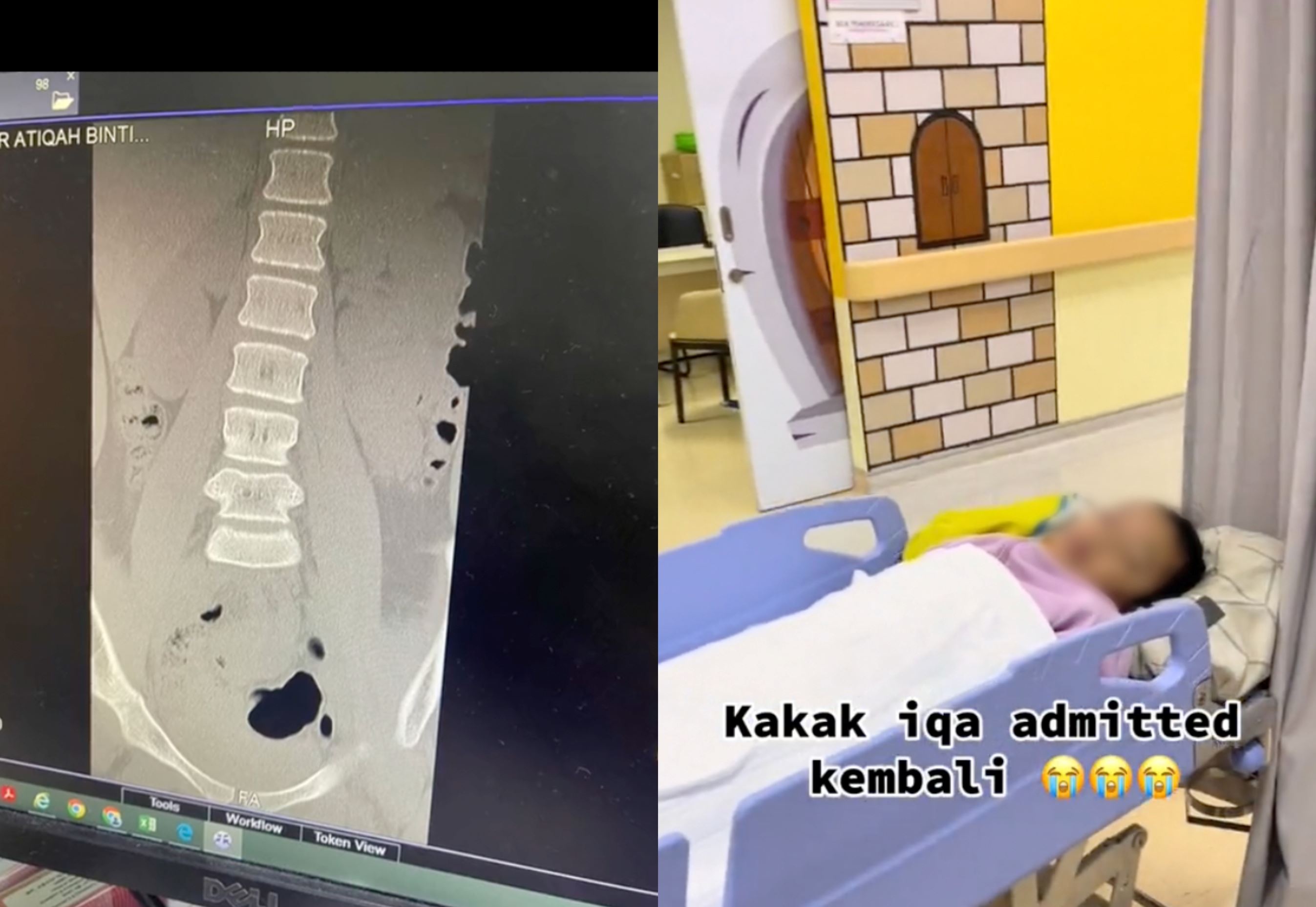 school chair-pulling prank renders malaysian girl with cerebral palsy bedridden