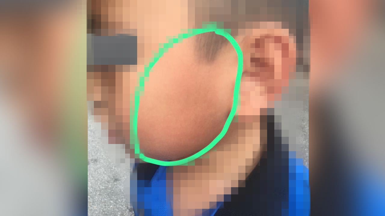 guru tampar anak murid sampai pipi bengkak?