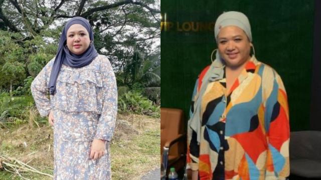 enot didakwa ‘buat muka’, bentuk muka nampak berbeza