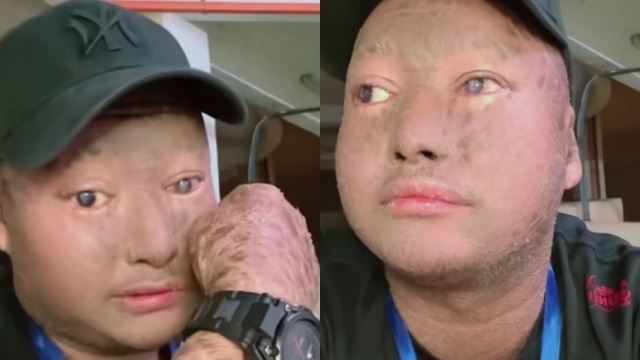 individu selamba hina pesakit kulit, netizen bagi amaran!