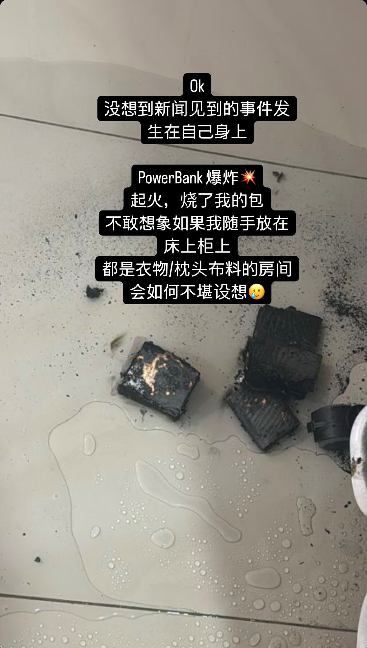 geraldine颜慧萍充电宝爆炸💥小腿被烫伤😱