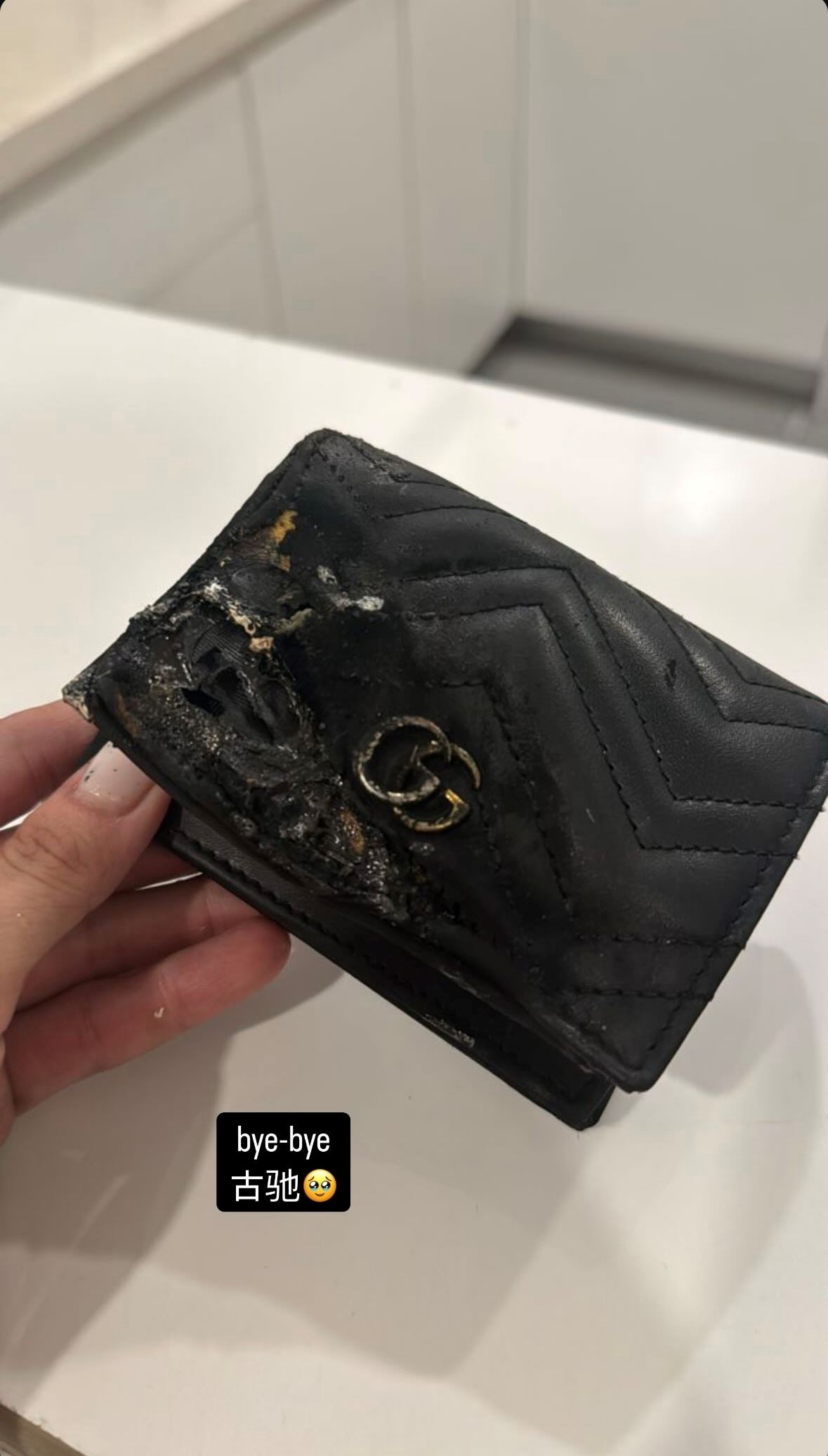 geraldine颜慧萍充电宝爆炸💥小腿被烫伤😱