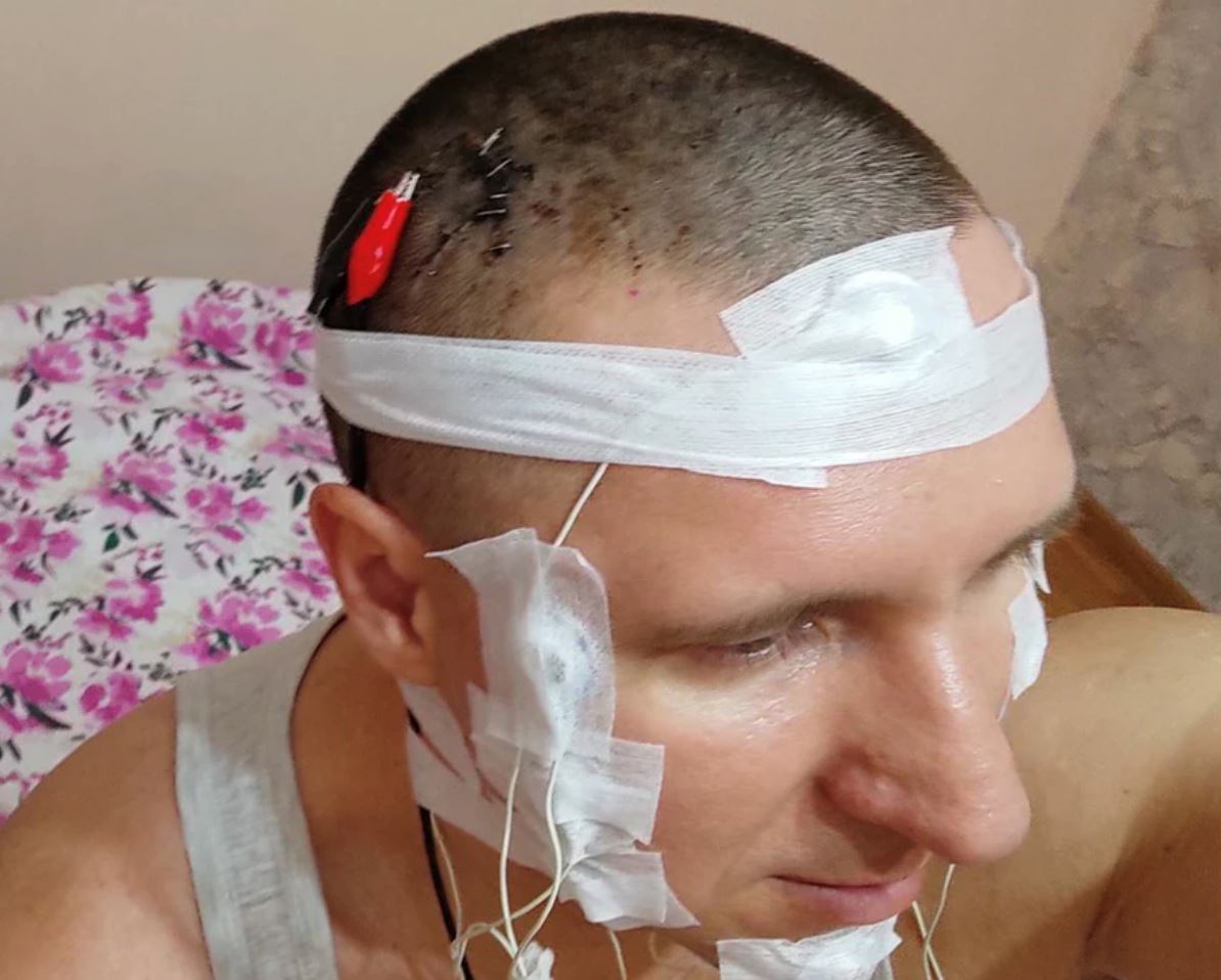 lelaki sanggup tebuk tengkorak, tanam cip dalam otak sebab nak kawal mimpi