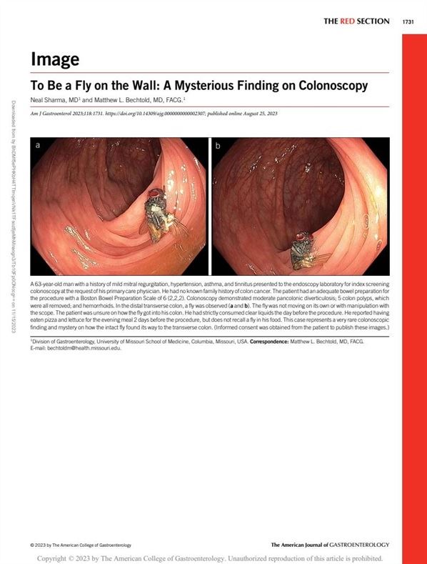 doktor terkejut jumpa lalat hidup dalam usus pesakit umur 63 tahun