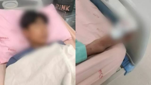 akibat terlalu kacak, remaja dibelasah sehingga cedera parah