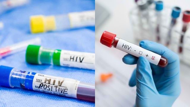 kes hiv di universiti meningkat, apa langkah perlu buat?