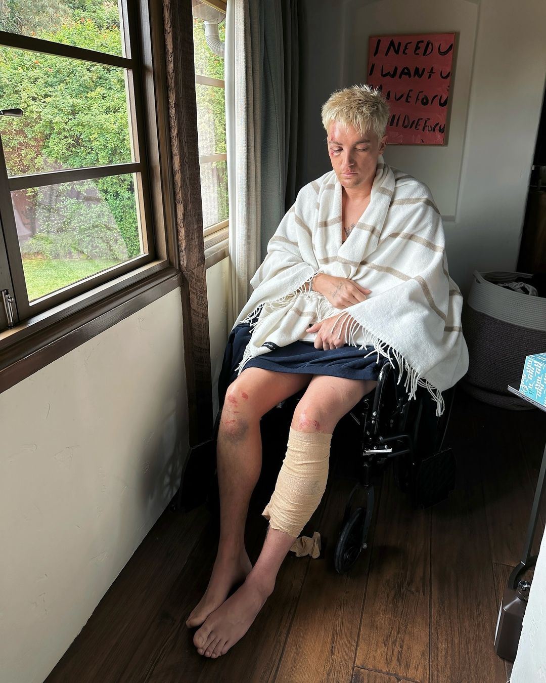 lany's paul klein hit by car: what we know so far