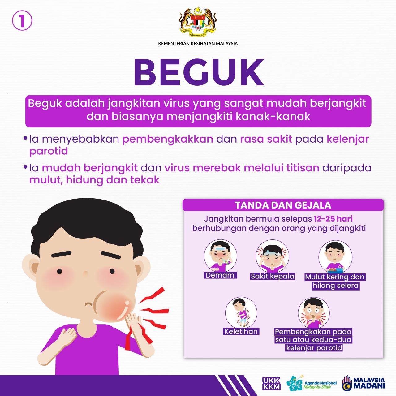 virus beguk mudah jangkit pada kanak-kanak, “boleh cegah dengan vaksinasi” – kkm