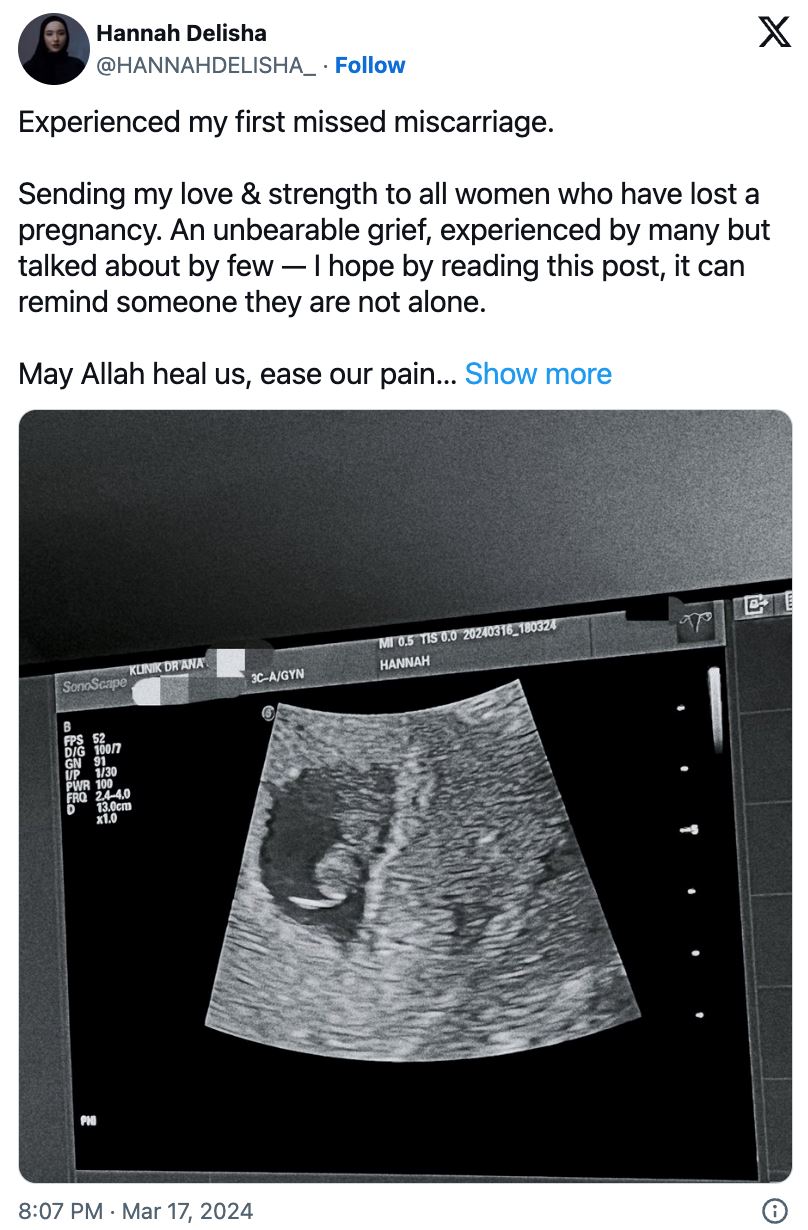 hannah delisha alami keguguran, “jumpa di syurga nanti sayang”