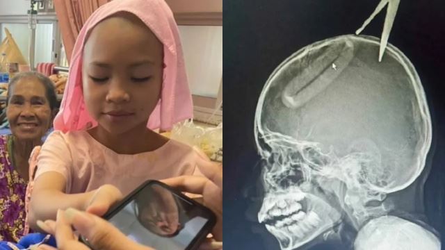 pengaruh cerita ganas, adik bertindak baling gunting di kepala kakak