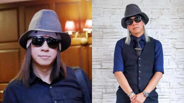 jay jay selamat jalani pembedahan, ada masalah jantung