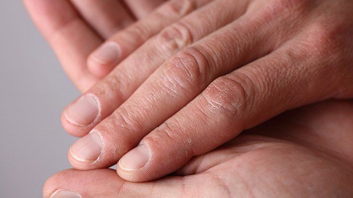 指甲月牙太少代表不健康？中医：当心影响生育！
