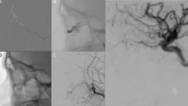 misteri! budak menangis sampai keluar air mata darah?