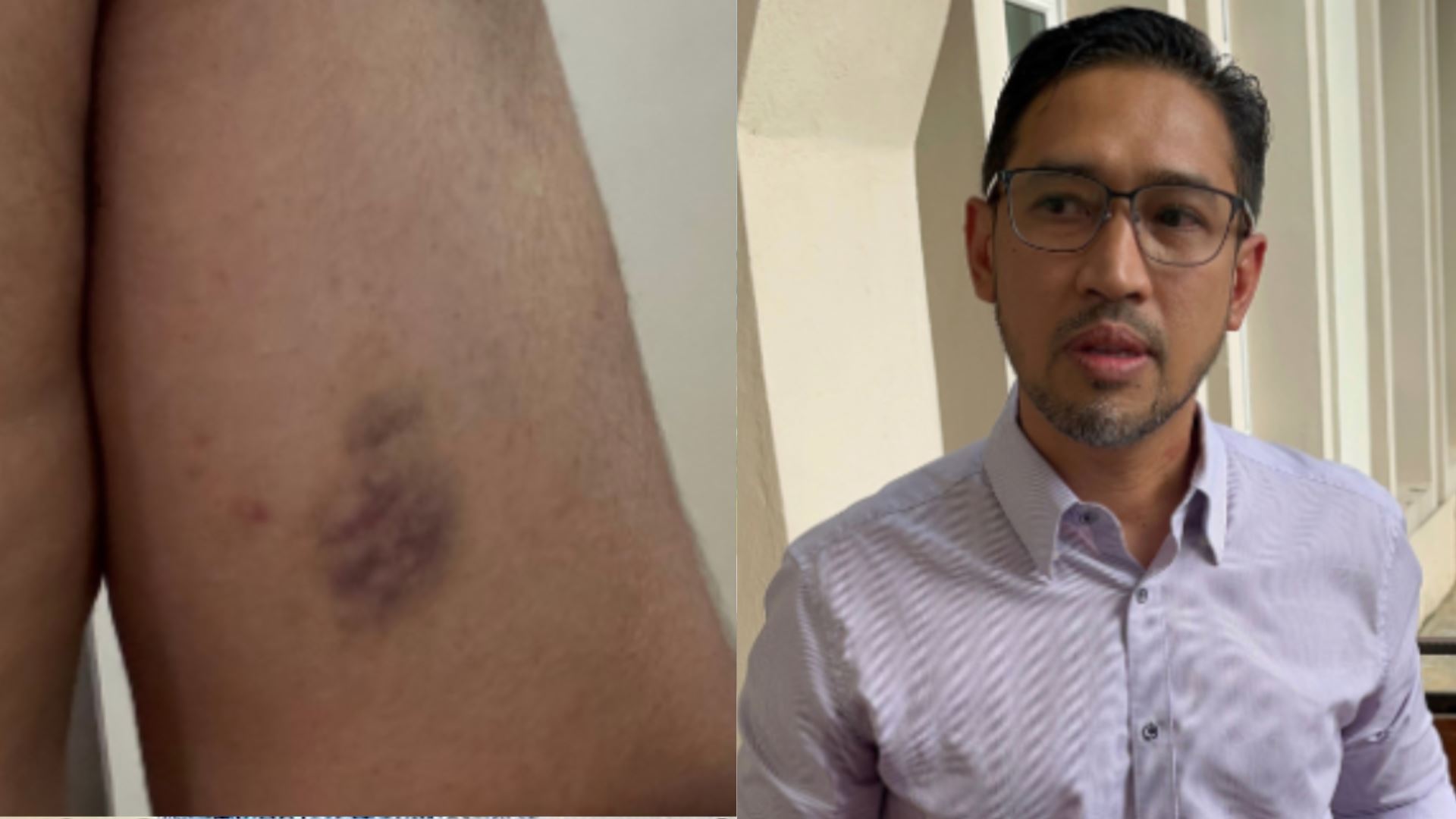 dakwa dipukul zehra zambri sebanyak 4 kali, suami hubungi talian nur