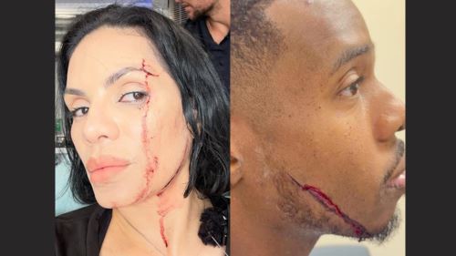 [video] “kami hampir mati!” pengalaman ngeri dua youtuber ketika sedang rakam food review