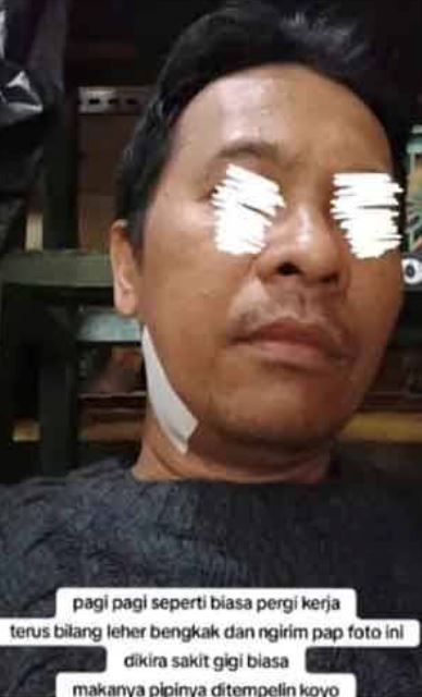 “never take a toothache lightly!” man dies after tooth infection spreads, relied only on painkillers