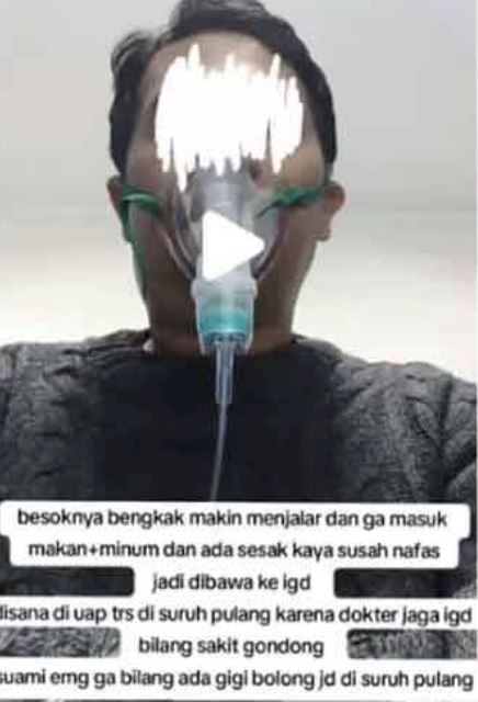 “never take a toothache lightly!” man dies after tooth infection spreads, relied only on painkillers