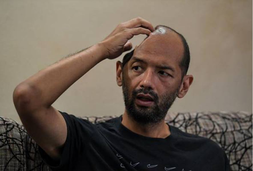 sufi selamat jalani pembedahan pasang implan tempurung kepala