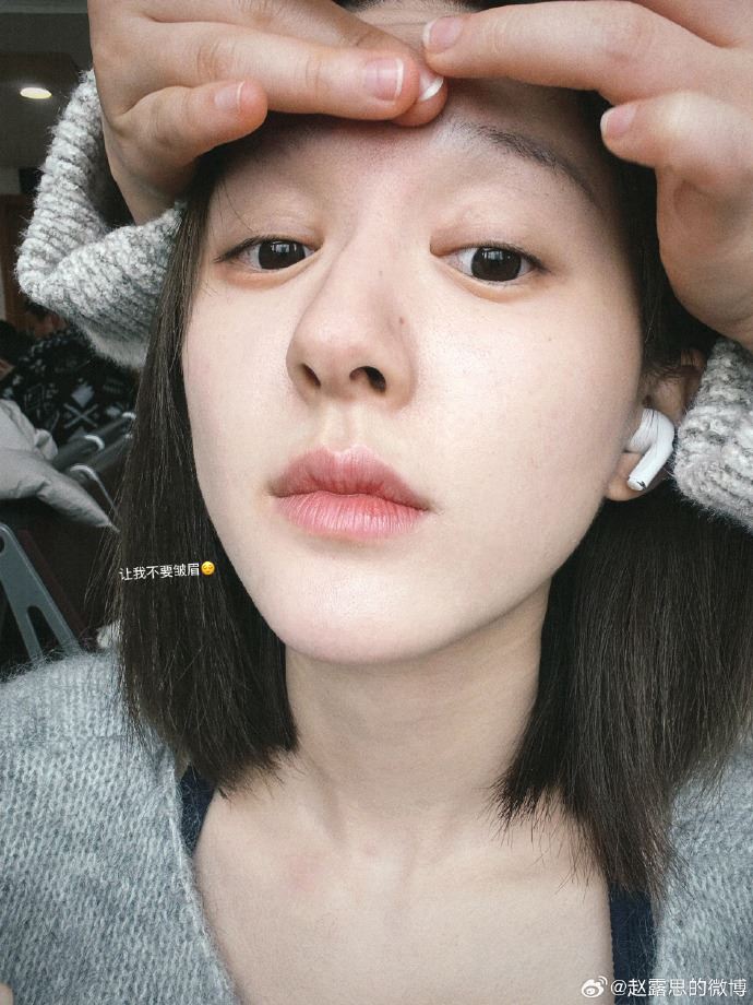 赵露思坦诚患抑郁症！承认遭殴打辱骂！