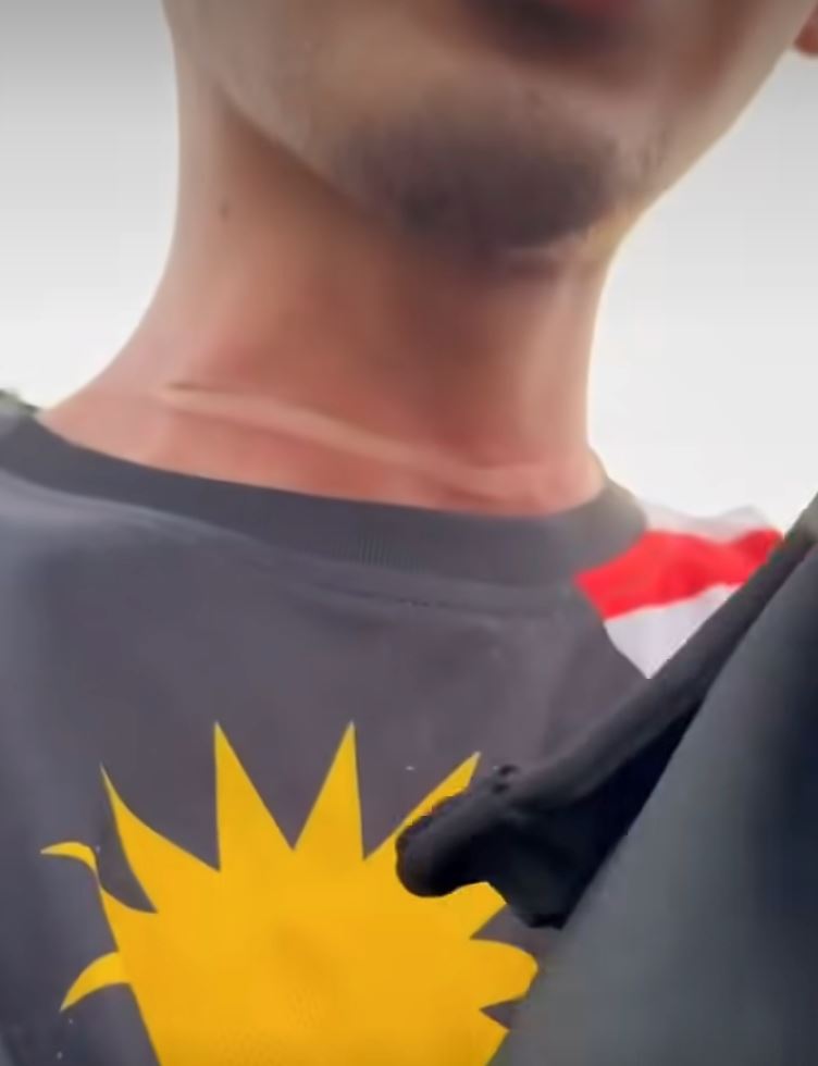 i could've died motorcyclist's neck slashed by kite string on mrr2, sparks safety warning