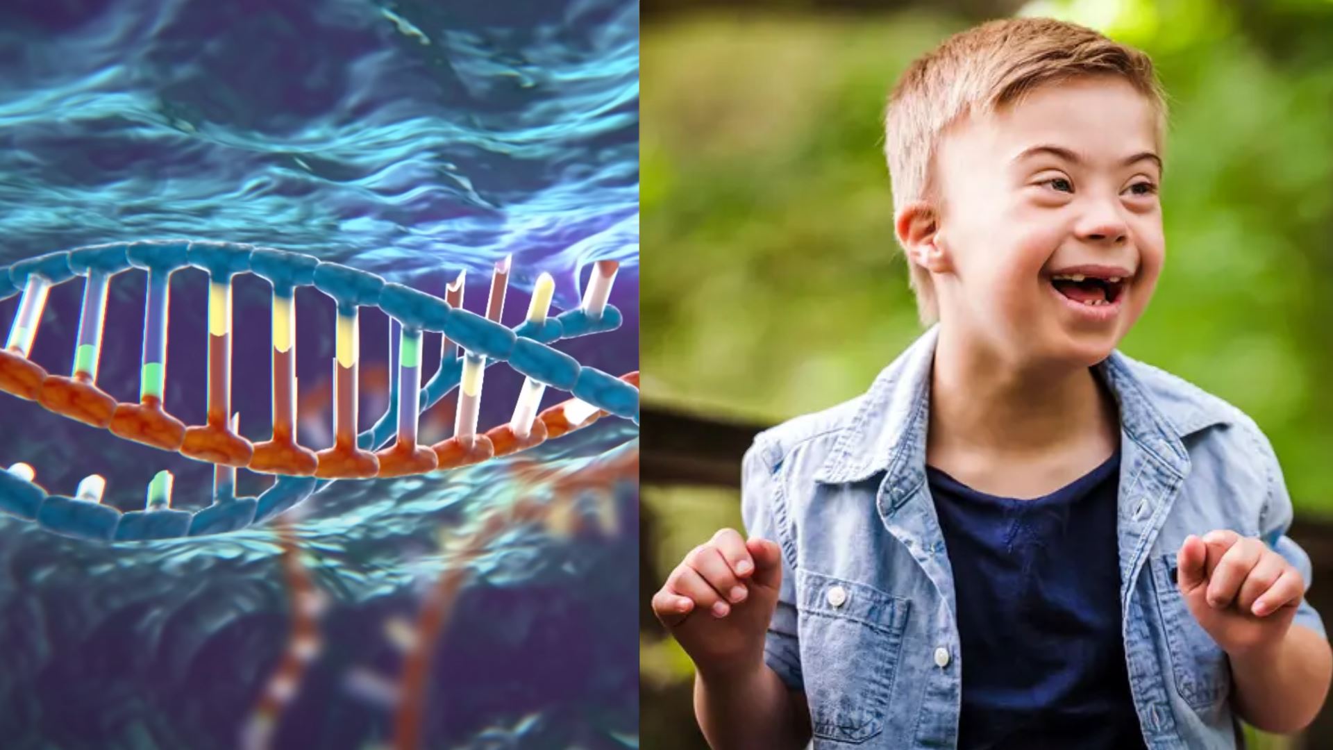 saintis jepun berjaya padam kromosom tambahan punca sindrom down