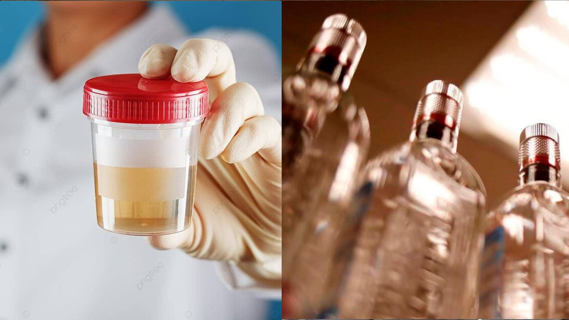 air kencing pesakit diabetes mampu ditukar menjadi alkohol mewah