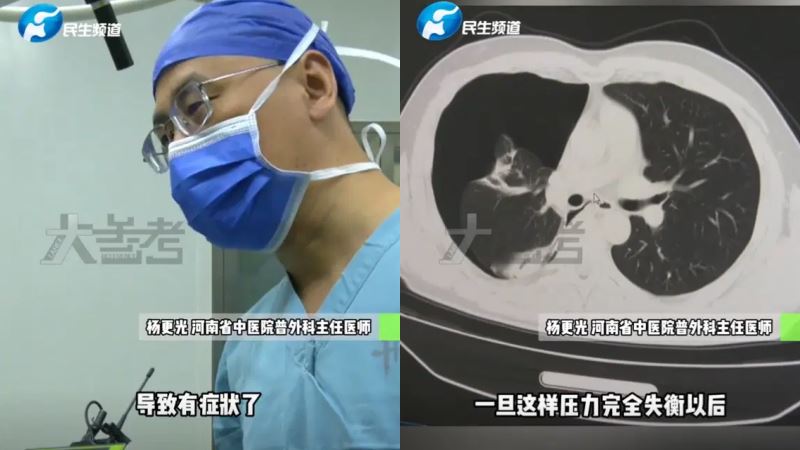 man’s lung collapses after new year’s fitness resolution goes wrong