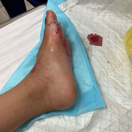 anak cedera 11 jahitan, keluarga dakwa villa diduduki abaikan keselamatan pelanggan