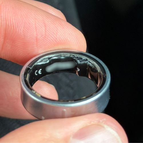 cincin pintar jadi mimpi ngeri: jari tiba-tiba membengkak, bateri kembung!