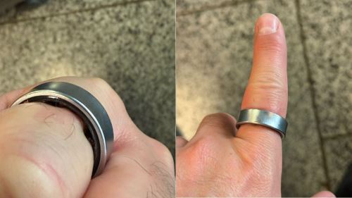 cincin pintar jadi mimpi ngeri: jari tiba-tiba membengkak, bateri kembung!