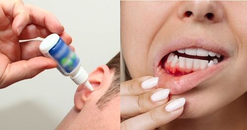 pesakit asma wajib baca, ini hukum sebenar guna inhaler menurut mazhab syafi’i!