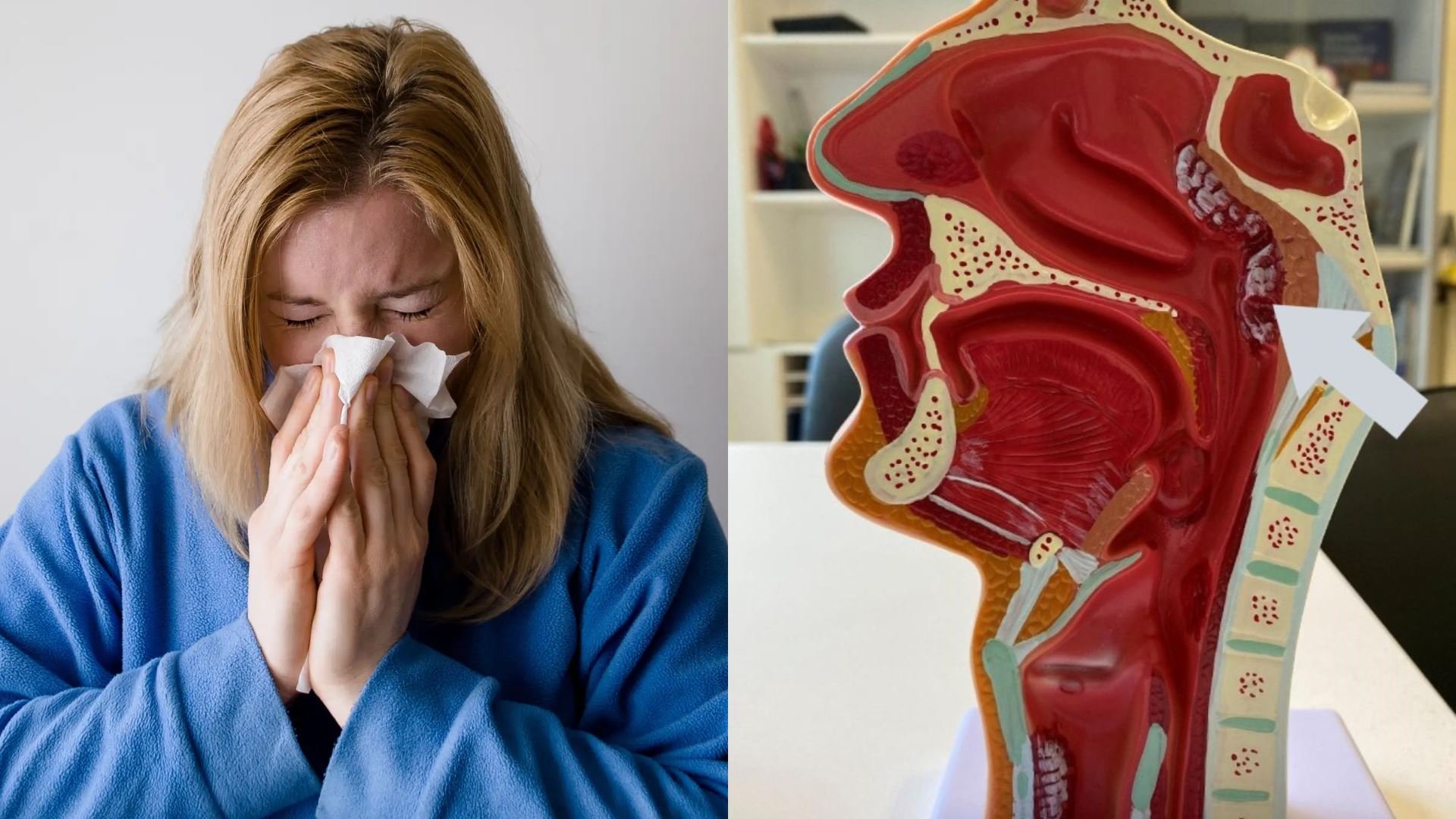 disangka resdung biasa, rupanya hidap kanser hidung