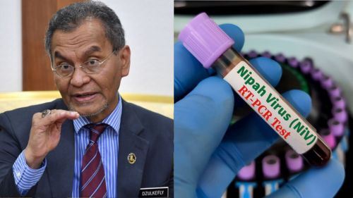 kkm keluarkan amaran: malaysia tingkat kesiapsiagaan hadapi ancaman virus nipah